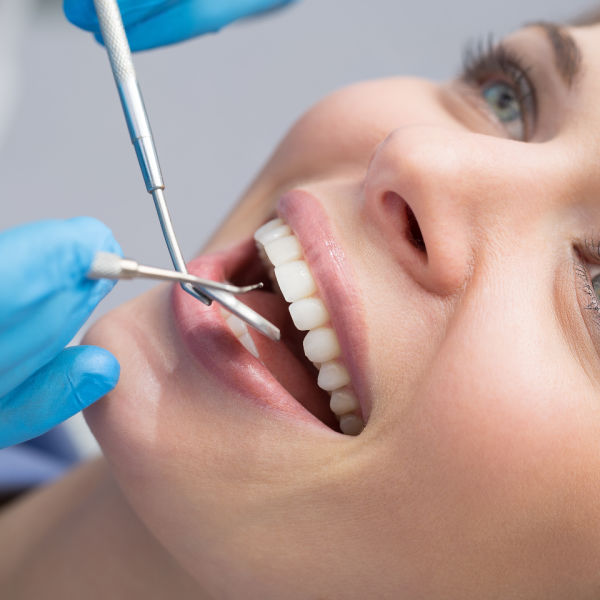 Dental Deep Cleanings in Fort Myers, FL