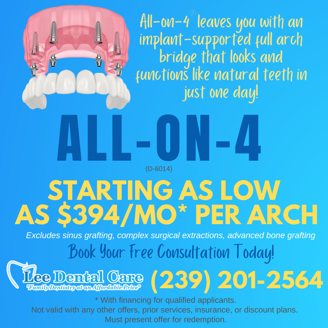 All-on-X $22,000 per arch