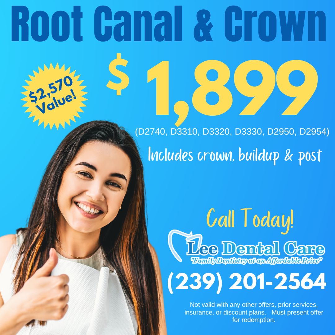 Root canal and crown $1,899