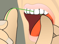 Flossing: Step 3